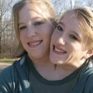 Abby and Brittany Hensel: A Love Story That Redefines Boundaries