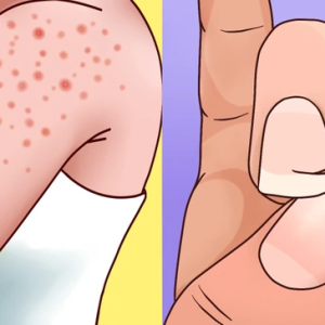 8 Unexpected Signs You Could Be Lactose Intolerant 8 Unexpected Signs You Could Be Lactose Intolerant