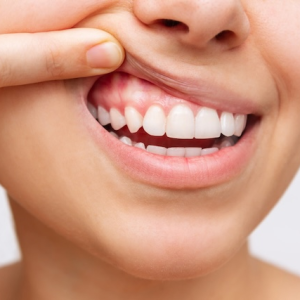 Why Gum Health is More Important Than You Think: A Complete Guide to Keeping Your Smile Bright