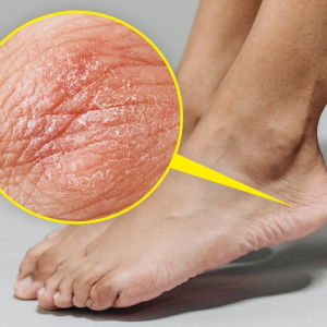 9 Health Signs Your Feet Might Reveal About Your Body 9 Health Signs Your Feet Might Reveal About Your Body