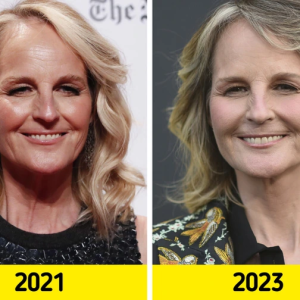 Helen Hunt, 61, Stuns in Red Carpet Appearance, Igniting Lip Controversy