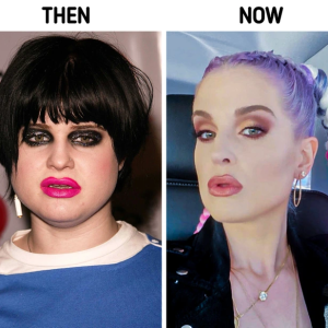 15 Stars Who Amazed Us With Their Radical Changes