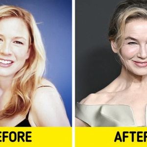 Renée Zellweger’s Stunning New Look Sparks Heated Debate—Fans Weigh In