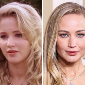 14 Celebrities Who Achieved Chiseled Cheekbones and Drastically Altered Their Looks 14 Celebrities Who Achieved Chiseled Cheekbones and Drastically Altered Their Looks