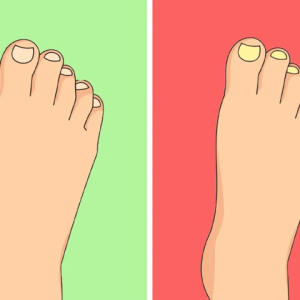 5 Subtle Health Clues Your Toenails Might Be Telling You 5 Subtle Health Clues Your Toenails Might Be Telling You