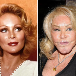 Hollywood’s Cosmetic Evolution: How Celebrities Redefine Beauty and Build Empires