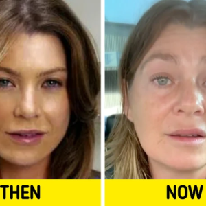 Grey’s Anatomy Cast: How They’ve Changed and Where They Are Now Grey’s Anatomy Cast: How They’ve Changed and Where They Are Now