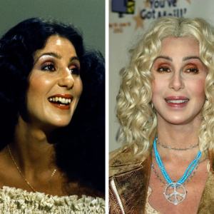 14 Celebrities Whose New Teeth Completely Changed Their Look 14 Celebrities Whose New Teeth Completely Changed Their Look