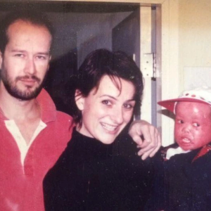 Couple Adopts a Red-Skinned Baby Everyone Thought Wouldn’t Survive—She Grew Into a Fighter and a Champion Couple Adopts a Red-Skinned Baby Everyone Thought Wouldn’t Survive—She Grew Into a Fighter and a Champion