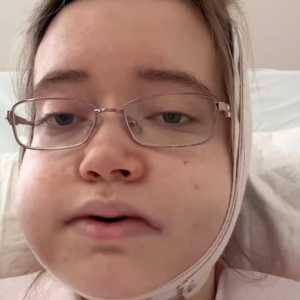 Singer Travels 24 Hours for Jaw Surgery and Stuns the Internet With Her Incredible Transformation