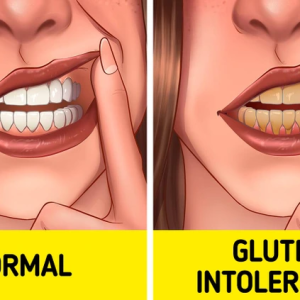 11 Surprising Signs Your Body Might Be Sensitive to Gluten