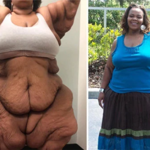Catrina Raiford’s Inspiring Transformation: From 955 Pounds to Freedom