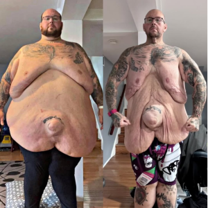 From 635 Pounds to Fighting Fit: Pete Brennan’s Unbelievable Weight Loss Transformation From 635 Pounds to Fighting Fit: Pete Brennan’s Unbelievable Weight Loss Transformation